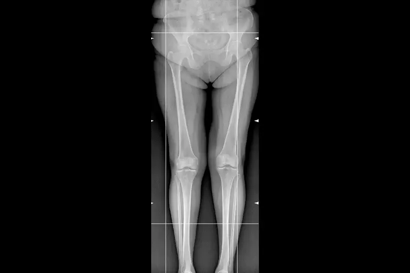 AI Software for Advanced X-Ray Analysis | Minerva Telemetry